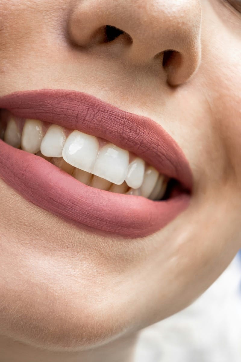 Bright white teeth after 30 days